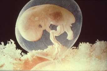 Embrio Adalah - Pengertian dan Jenis